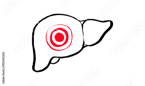 Liver disease concept