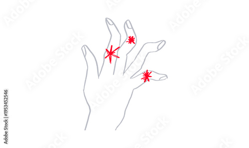 Arthritis Sketch Poster