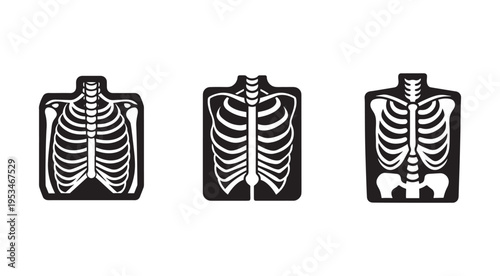 Human skeleton anatomy xray images in different views  medical illustrations of ribcage and spine