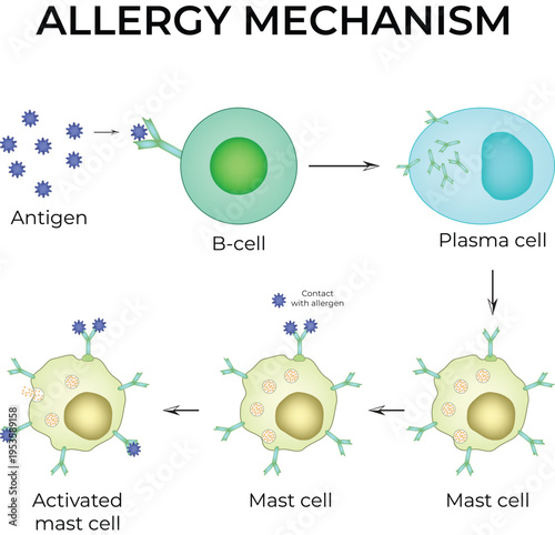 Allergy Mechanism. The allergy cascade process detailing the steps from allergen to IgE to mast cell, and then to histamine release.