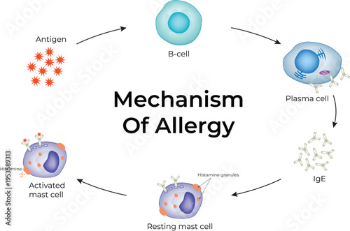 Allergy Mechanism. The allergy cascade process detailing the steps from allergen to IgE to mast cell, and then to histamine release.