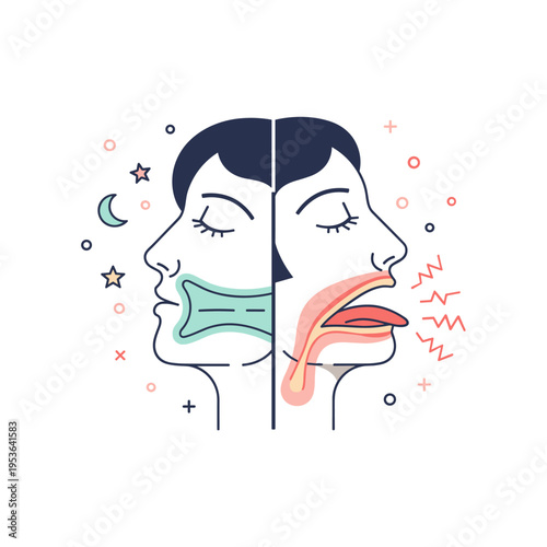 Conceptual Vector Art of Sleep Apnea Airway Blockage