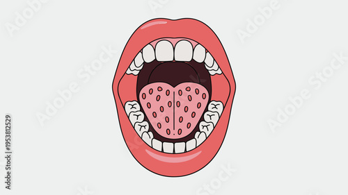 Open mouth with inflamed tongue illustration representing oral disease and infection symptoms