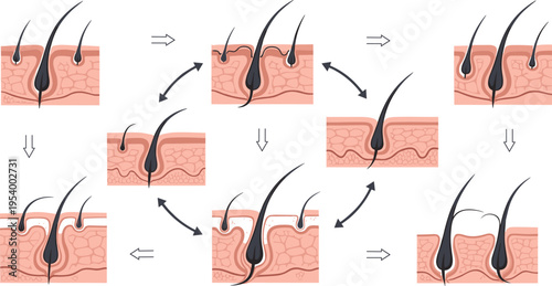 Hair growth cycle stages diagram with follicle development phases scalp process vector illustration