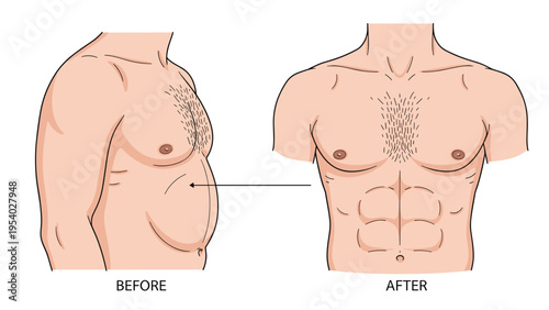 Before and after fitness transformation showing a male torso changing from overweight to muscular with abs.
