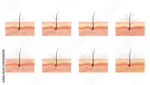 Comparative medical diagrams showing different stages of human hair follicle growth and various skin health conditions.