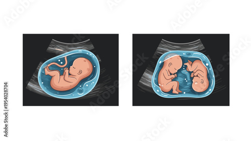 Prenatal ultrasound scan comparison showing the difference between a single fetus and twin fetuses in the mother womb.