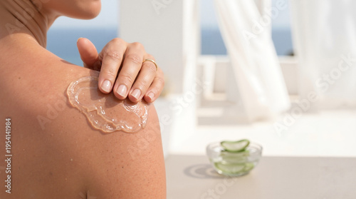Adult female with light skin applying clear aloe vera gel to her sunburnt red shoulder on a sunny balcony