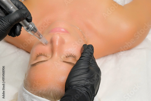 Woman receiving microneedling treatment on her face for skin care at a beauty clinic