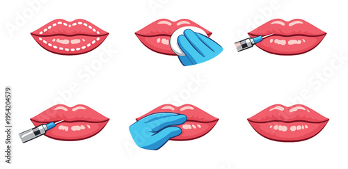 Lip injection steps and preparation on dark gradient background