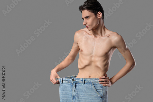 Young man with anorexia in ...