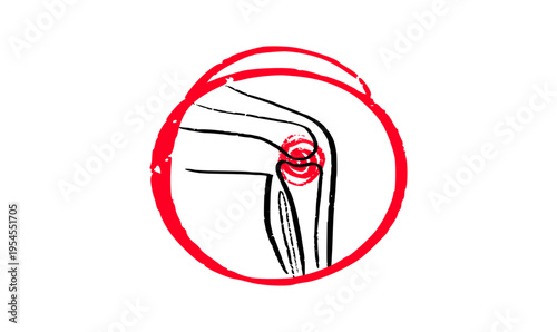 Arthritis Sketch Poster