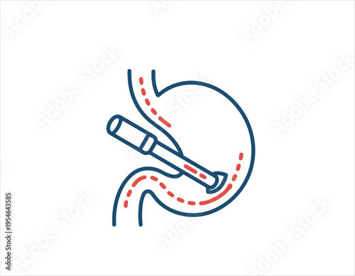 An educational red and blue outline icon depicts an endoscope examining the human stomach