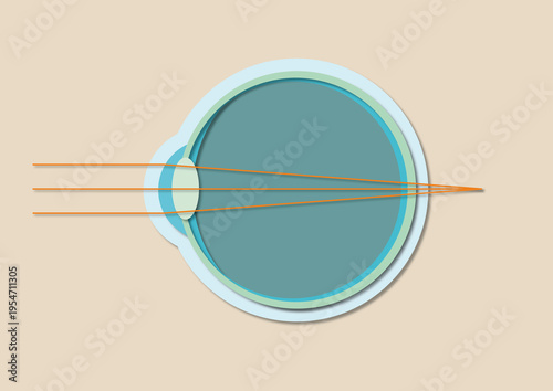 Far-sightedness, illustration