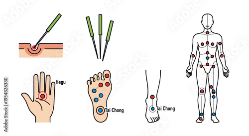 Acupuncture Points and Needles Diagram on Human Body.