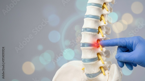 Medical spine model lumbar vertebra spinal disc back pain nerve compression herniated disc orthopedic care doctor hand blue glove healthcare concept detailed medical spine model showing lumbar