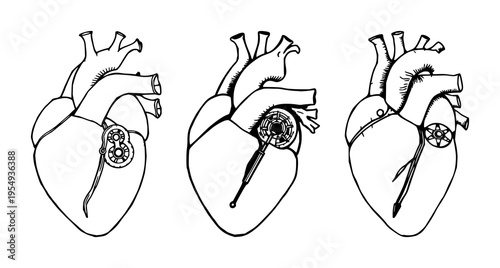 Human heart set with hand-drawn scientific illustration featuring mechanical valves, bioengineering detail, black ink with white background and outlining