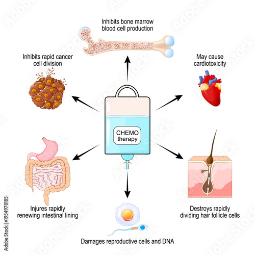 Chemotherapy affects cancer and normal tissues. Chemotherapy side effects. Tumor regression.