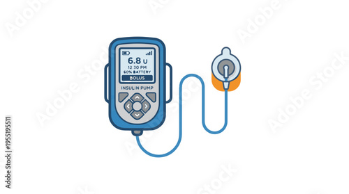 A blue insulin pump with a screen displaying insulin levels and battery, connected by a thin tube to an infusion set.