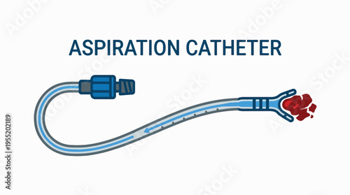 Illustration of an aspiration catheter with a blue connector, flexible tubing, and a claw-like tip extracting red material.