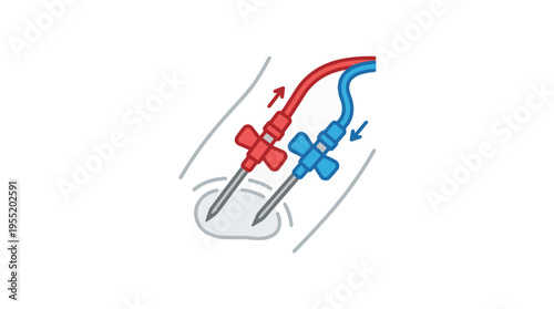 Illustration of two cannulas inserted into an arm, with red and blue tubes indicating blood flow direction.