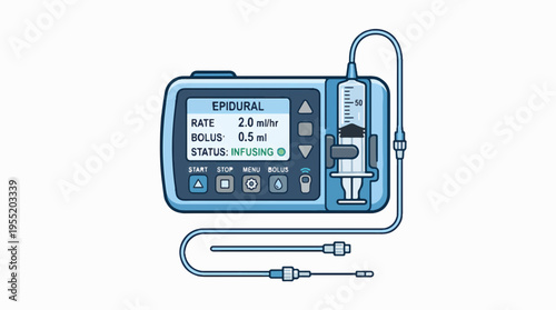 A blue medical epidural infusion pump illustration displaying 'INFUSING' status, rate 2.0 ml/hr, bolus 0.5 ml, with an attached syringe and tubing on a white background.