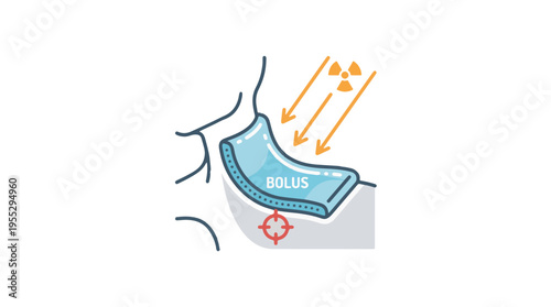 Medical icon illustrating radiation therapy. A blue bolus material is placed on a body surface, with radiation beams (orange arrows) being directed towards a specific target area underneath 