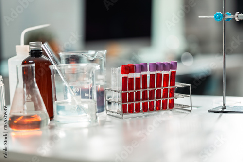 Blood sample test tube laboratory medical analysis healthcare hospital research diagnostic science blood sample test tube laboratory bench, medical analysis scene bright healthcare research center