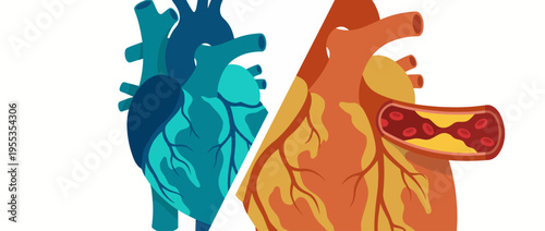 An educational and visually striking representation of healthy and clogged heart anatomy, highlighting the importance of cardiovascular health and wellness.