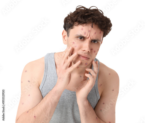 Young man ill with chickenp...