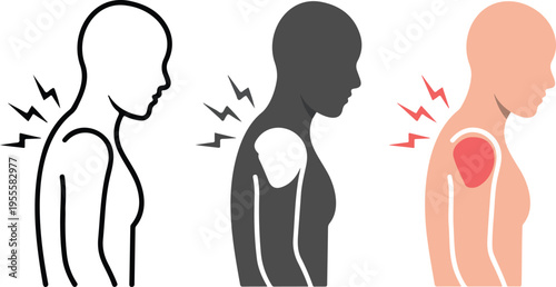Set of three minimalist human shoulder and upper back icons with pain symbols for orthopedic health physical therapy and posture concepts isolated on white.
