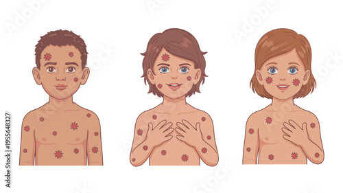 Children with chickenpox spots illustration