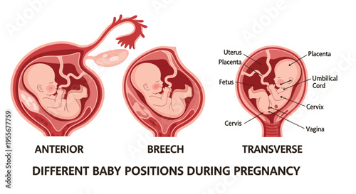 Illustrative vector diagram showing various baby positions inside the uterus during human pregnancy.