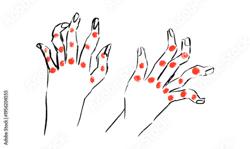 Arthritis Sketch Poster