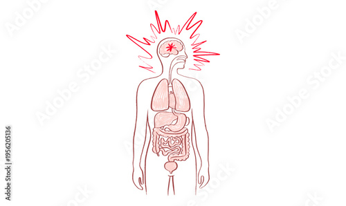 Brain disease concept