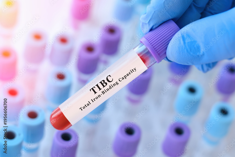 Obraz premium Doctor holding TIBC blood test tube explaining total iron binding capacity for iron deficiency assessment and anemia diagnosis in clinical laboratory medicine concept