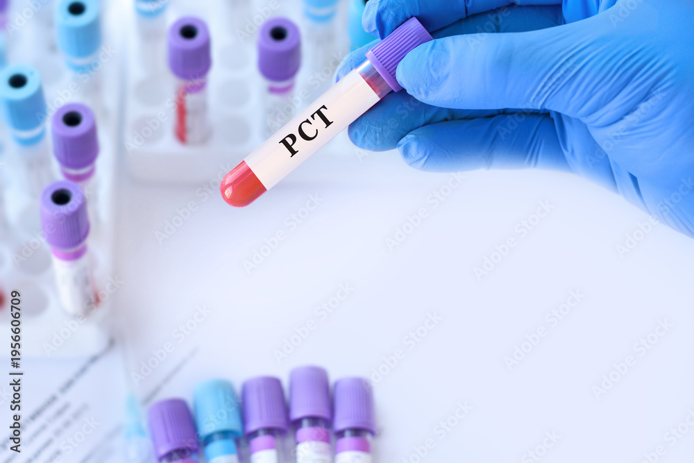 Naklejka premium Doctor holding blood sample tube with PCT test measuring procalcitonin levels for early detection of bacterial infection, sepsis diagnosis and inflammation assessment in modern laboratory medicine