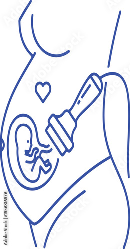 A blue outline illustration of a medical ultrasound procedure performed on a pregnant woman belly isolated on transparent background, isolated on white background, Vector