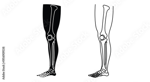Anatomical illustration of human legs and feet in a dark silhouette