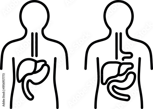 Comparison of human digestive systems with and without a specific organ highlighted