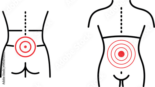 Anatomical diagram highlighting the lower abdominal and pelvic regions with target zones