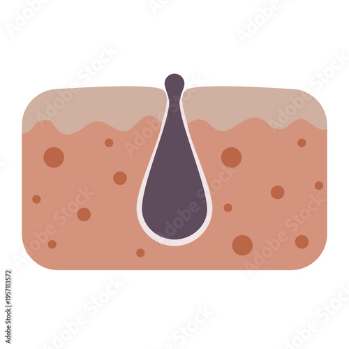 Clogged Pore Blackhead Skin Acne Deep