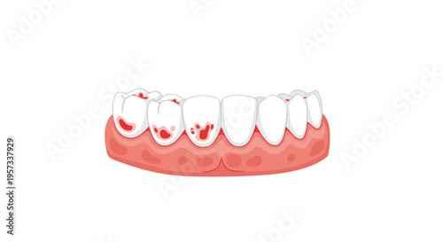 An illustration displays a set of white teeth with inflamed and bleeding pink gums on a plain white background.