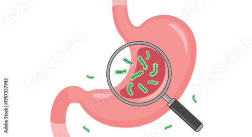 An illustration shows a pink stomach with green bacteria magnified inside and scattered around on a white background.