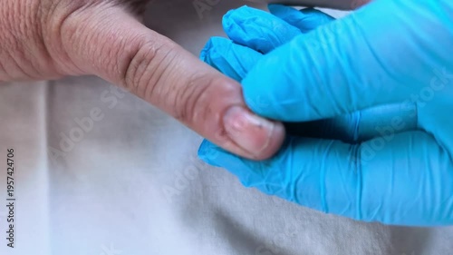 A healthcare worker performs a medical procedure by injecting a needle into the finger of a patient. The setting is a clinic with bright lighting.
