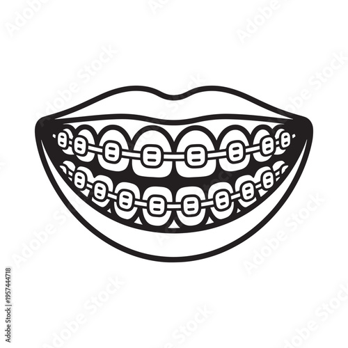 A black and white illustration of smiling lips with dental braces