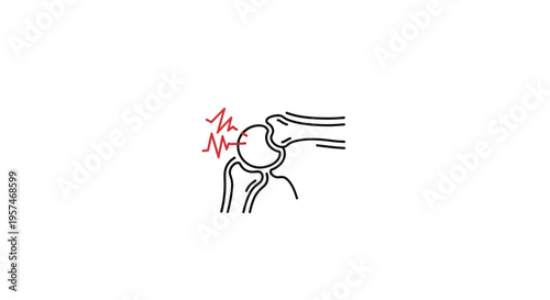 A vector graphic illustration of a human knee joint with a red pain symbol