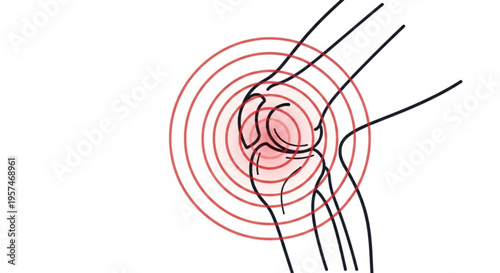A vector graphic illustration of a knee joint with red concentric circles and black lines radiating from it, representing pain or inflammation.