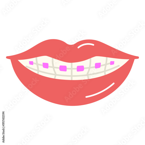 Orthodontic treatment