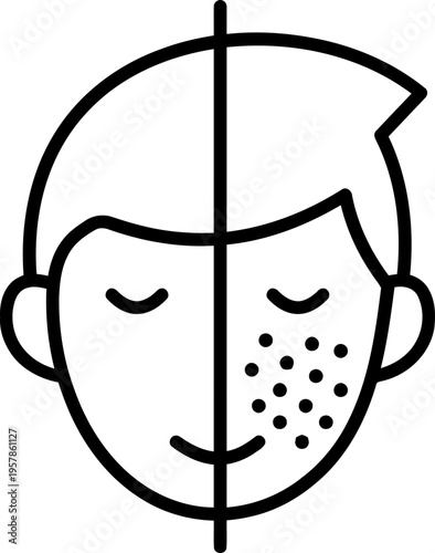 Acne Face Half Illustration.